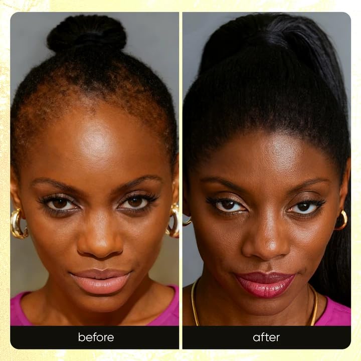 Root Revive Capsules – 90 Capsules | Supports Healthy, Thicker-Looking Hair | with Black Seed, Bamboo & Pumpkin Seed Extracts, Biotin & 17 Growth Ingredients