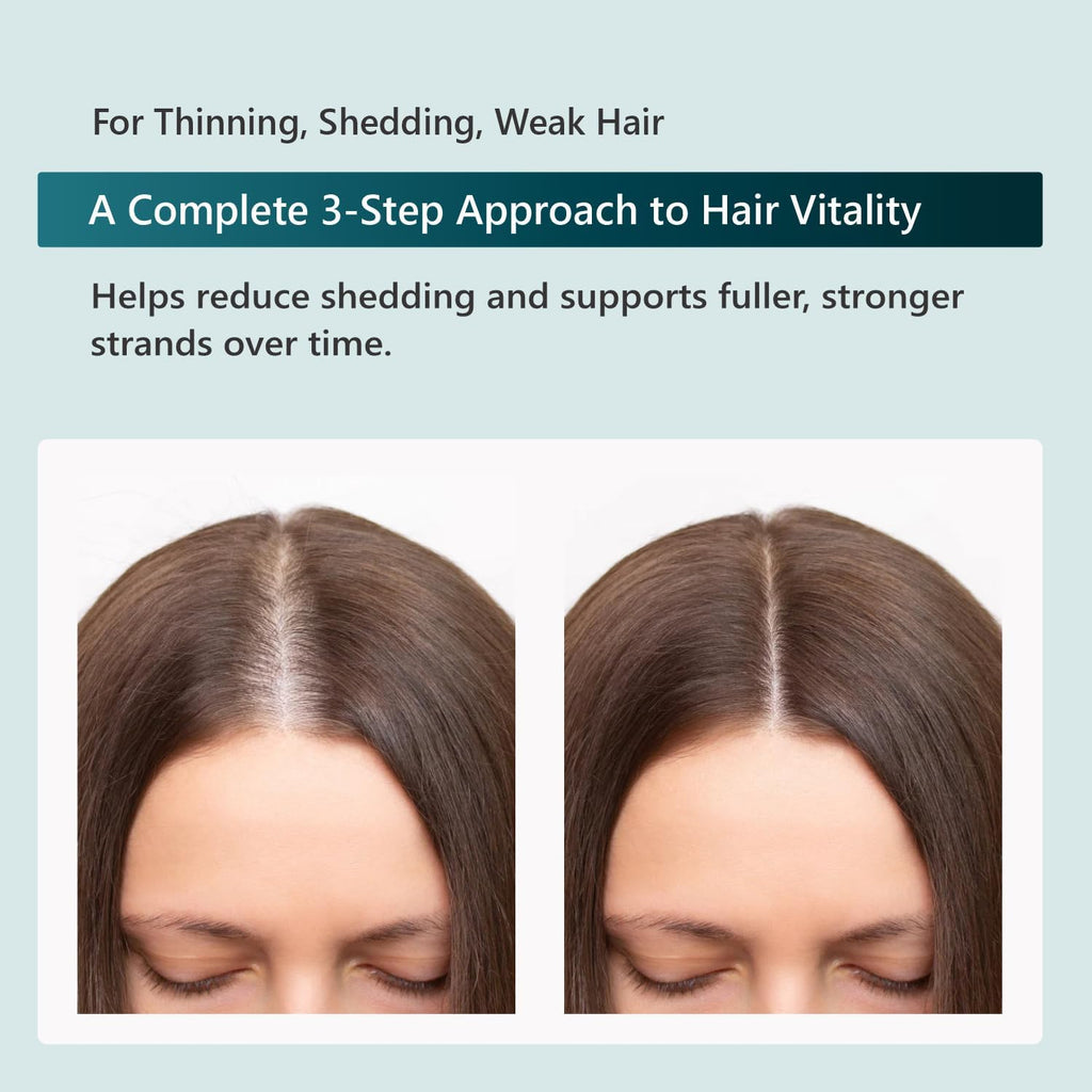 SUN COAST SCIENCES RejuvaTress from Hair Support Supplement for Women | Doctor-Formulated with Saw Palmetto, Biotin & AnaGain Nu | Supports Thicker, Stronger, Healthier Hair | 60 Capsules