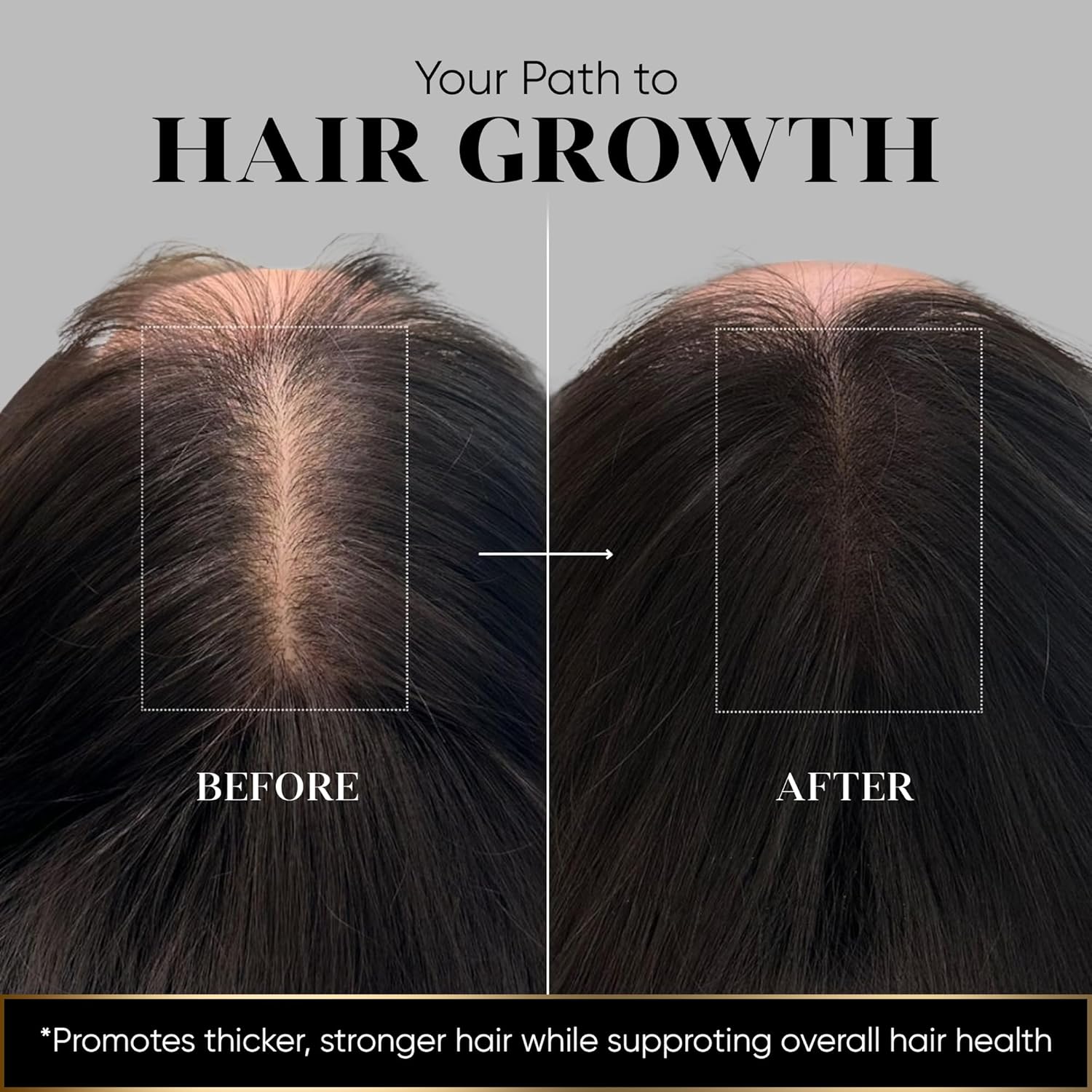 Vita Hair (Micronized Formula) Growth & Hair Loss Supplement – 100% Natural for Healthier Hair – Supports Hair Growth, Reduces Hair Loss, and Combats Graying for Men & Women – 108 Capsules